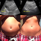 Castor Oil Detox Pack  - Parasite Cleanse