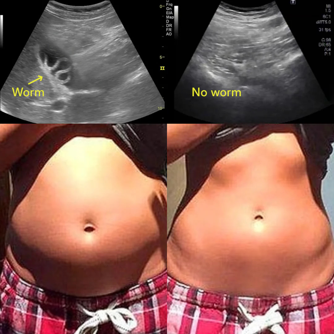 Castor Oil Pack Bundle