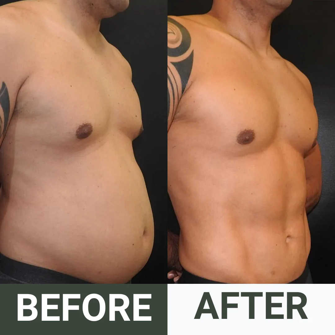 Castor Oil Pack Bundle