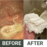 Castor Oil Detox Pack  - Parasite Cleanse